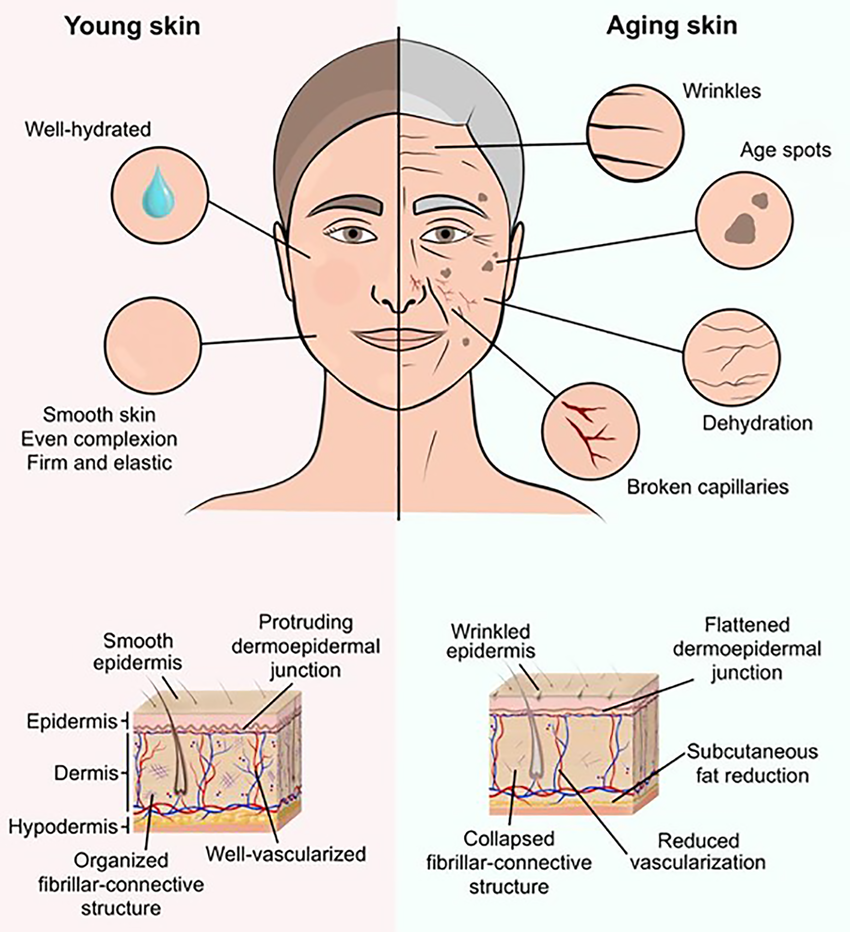 Three Types Of Aging – Skin Glow Pro at Colorado Skin & Vein